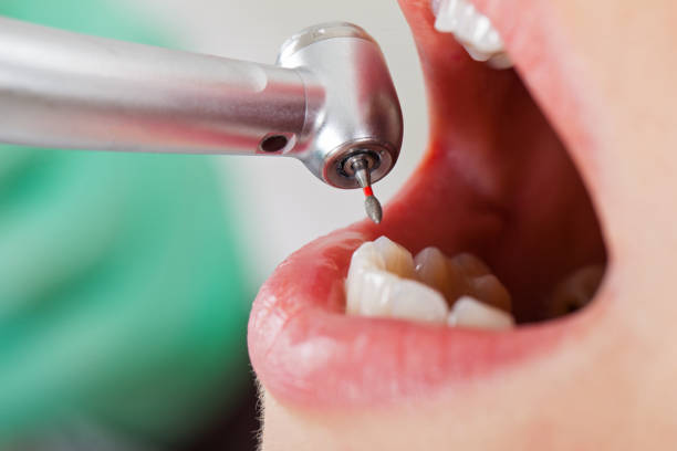 Best Emergency Dentist for Knocked-Out Tooth in Elleale, ND